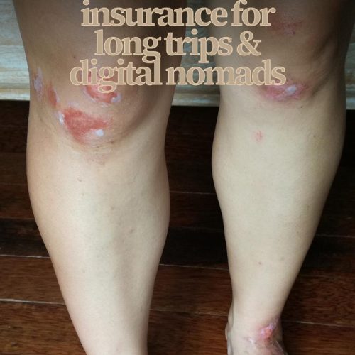 scraped legs and feet